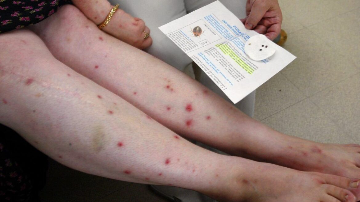 Comment lutter contre les punaises de lit ?