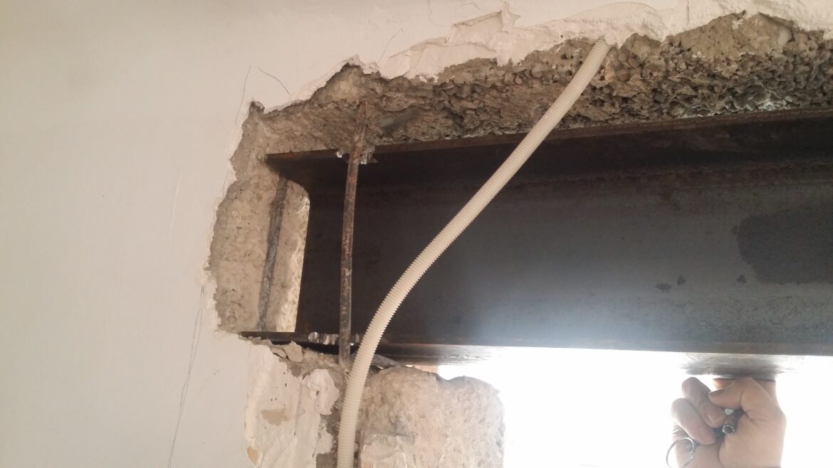 Quel prix pour poser un IPN ?