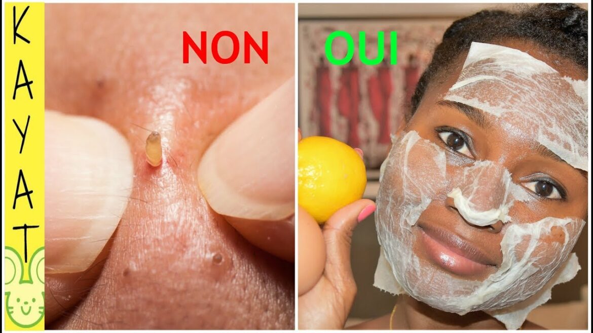 Comment enlever le noir des tuiles ?