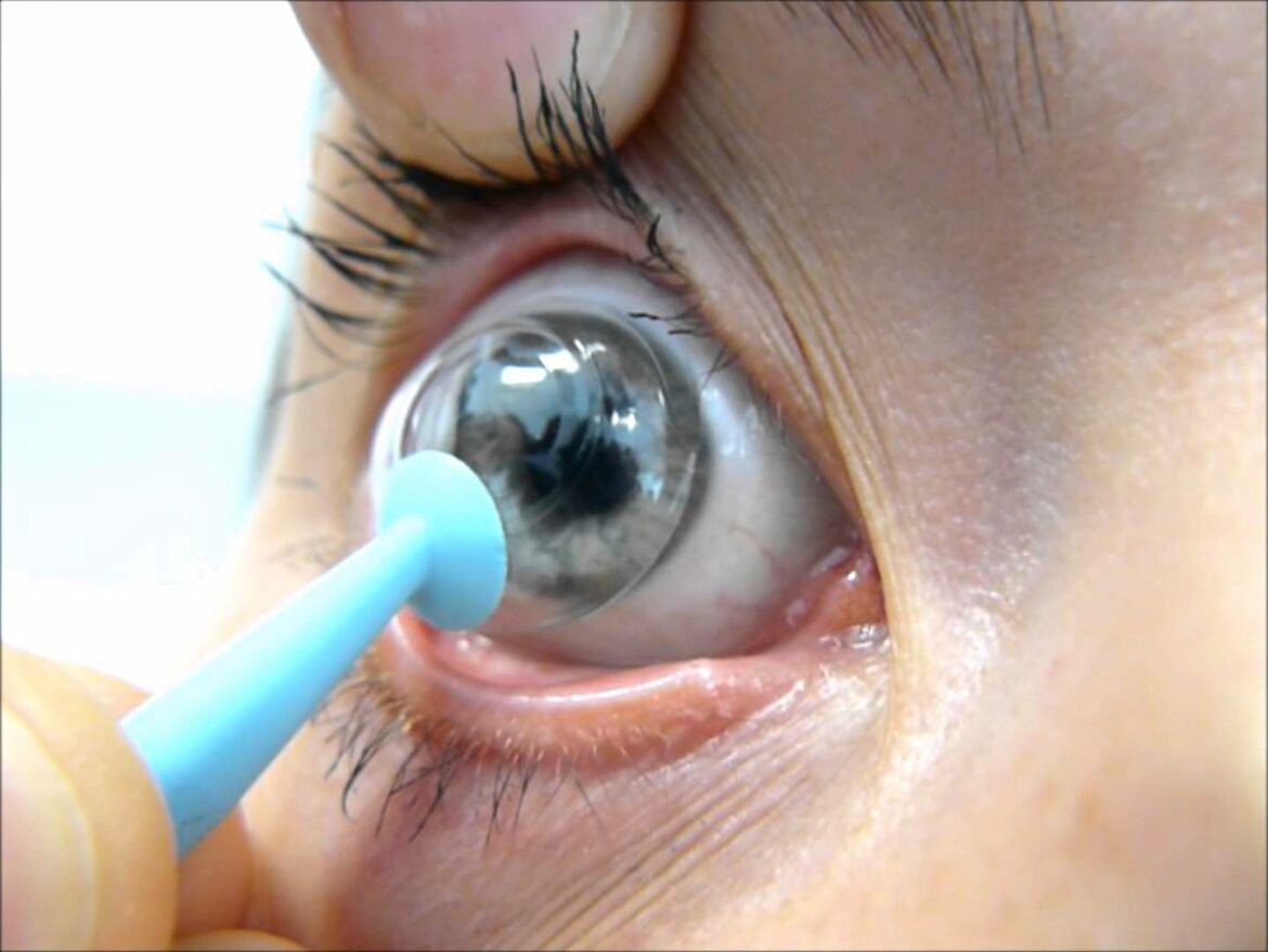 Comment mettre des Faitieres ?