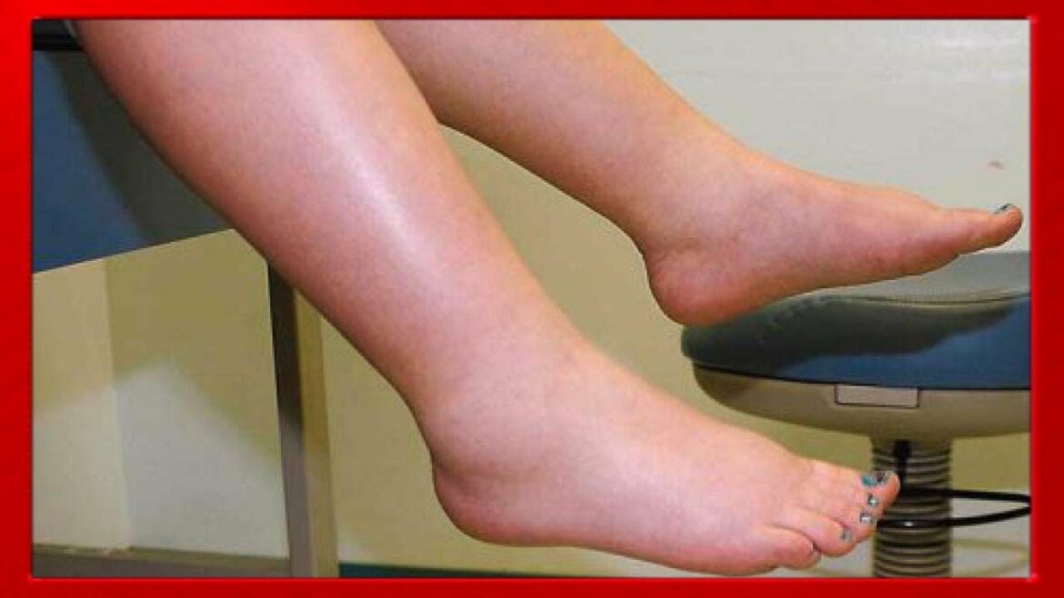 Comment surélever ses jambes ?