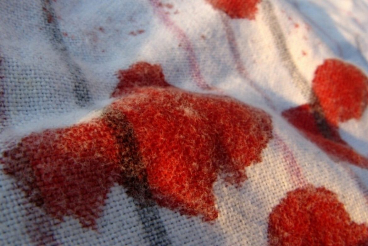 Comment enlever des taches de sang anciennes ?