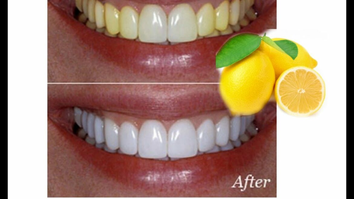 Comment faire blanchir du teck ?