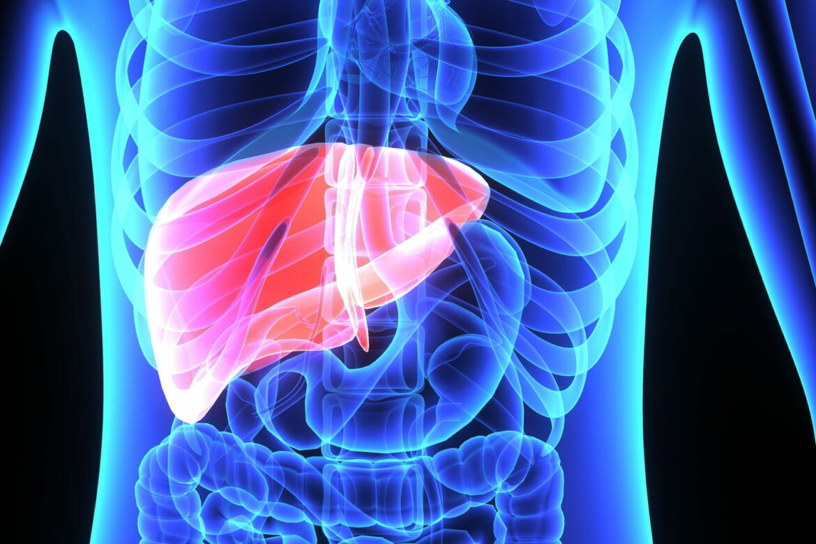 Comment soigner une hépatomégalie ?