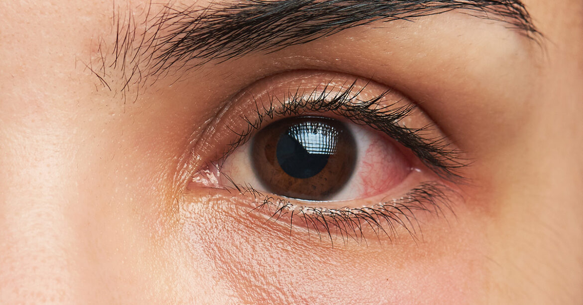 How long does a tiny house last?