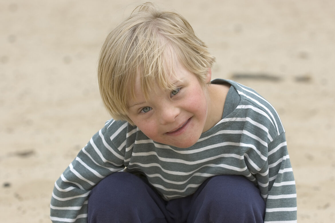 Quelle est la trisomie la plus grave ?