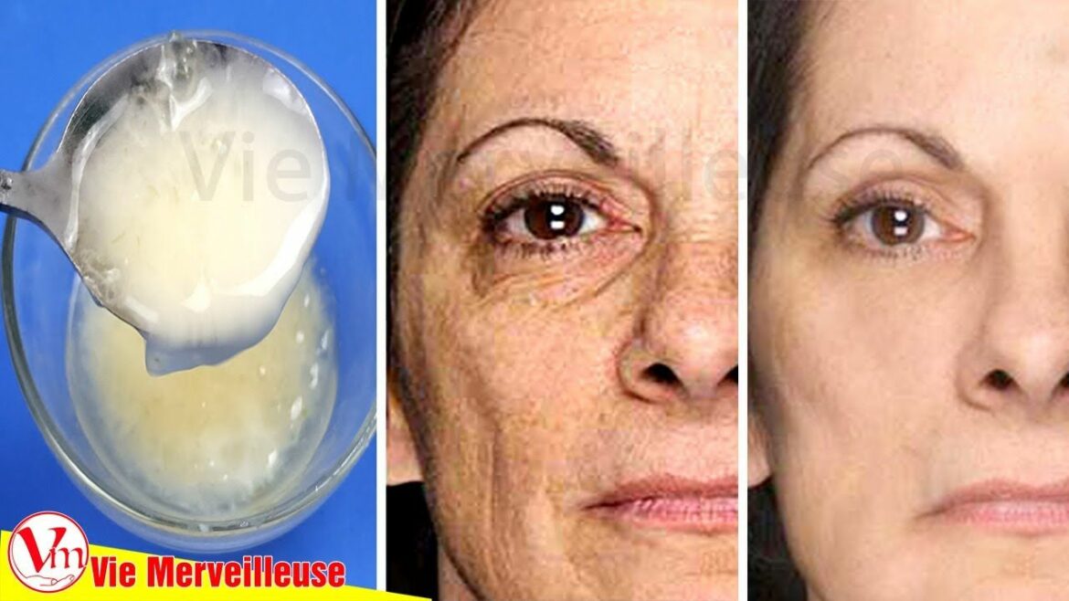 Est-ce que le citron enlève les taches brunes ?