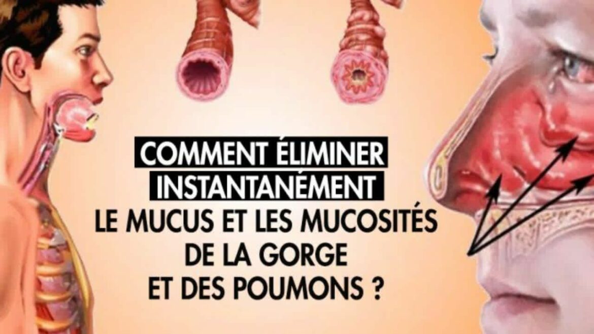 Quel médicament pour eliminer les glaires ?